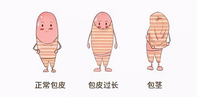 儿童包皮一定要切吗,鸡西三健男科医院